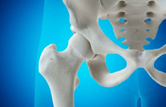 orthopedic medical device2
